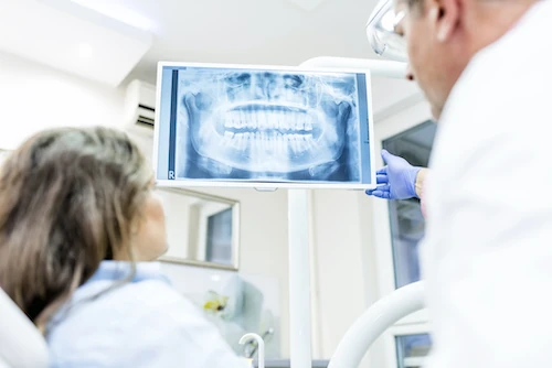Digital x-rays at keith + associates dentistry in Mission, KS.
